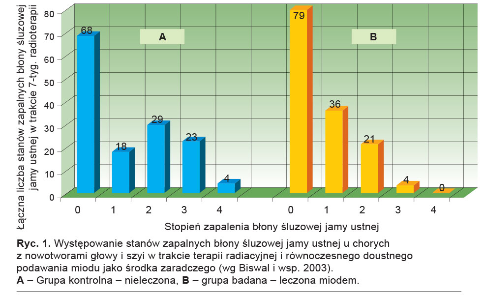 Występowanie stanów zapalnych błony śluzowej jamy ustnej u chorych z&nbsp;nowotworami głowy i szyi w trakcie terapii radiacyjnej i równoczesnego doustnego podawania miodu jako środka zaradczego (wg Biswal i wsp. 2003). 