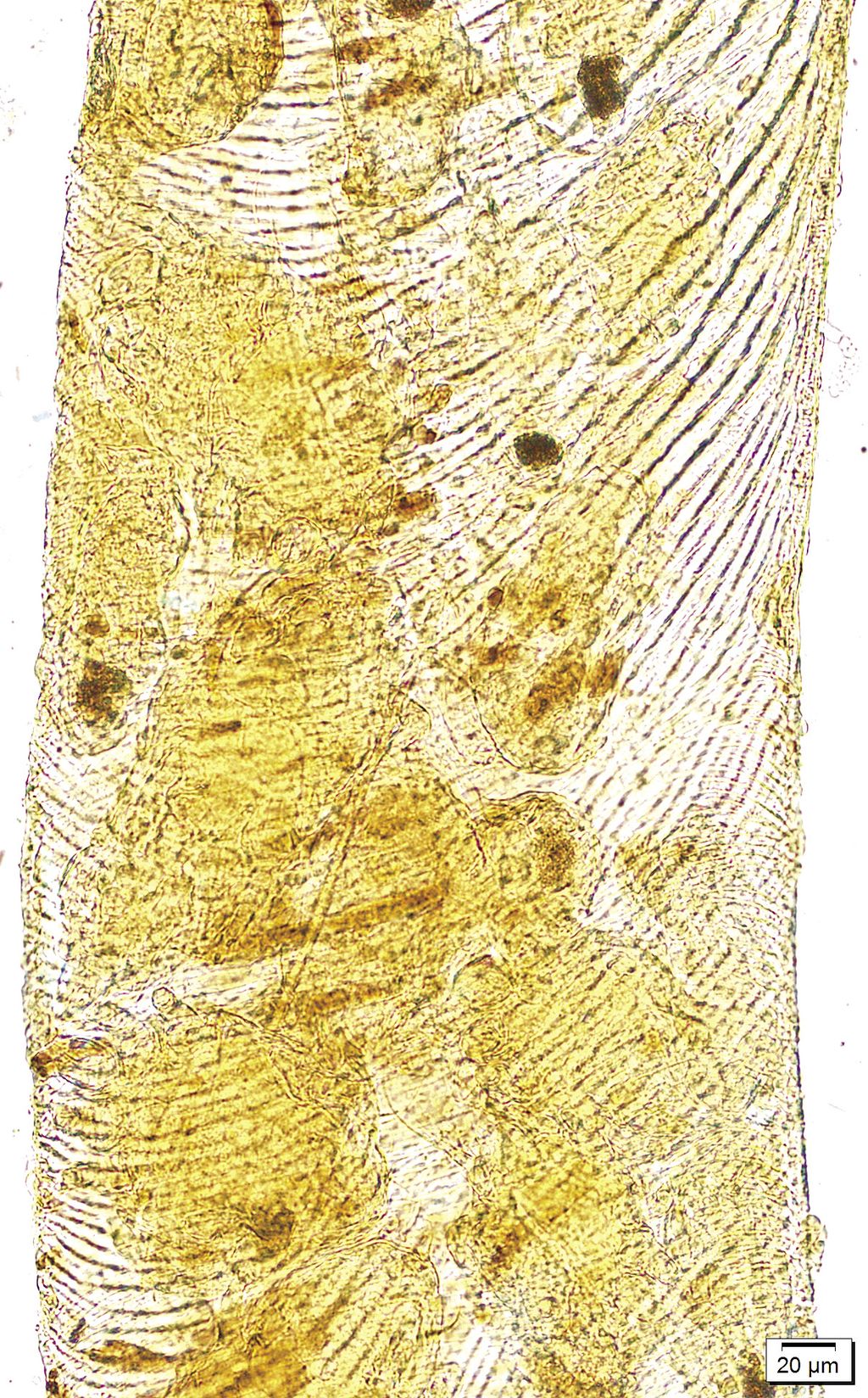 n2_Fot_4_Tchawka_z_widocznymi_wewnatrz_Acarapis_woodi